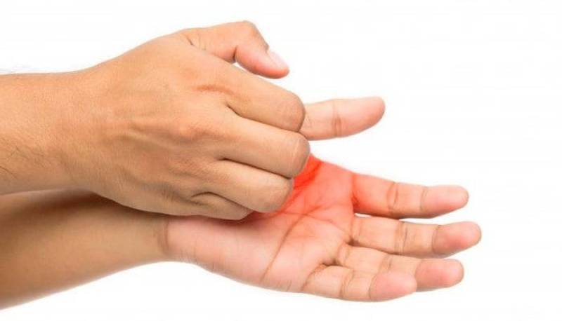 خارش کف دست، خبر از پول می‌دهد یا بیماری؟